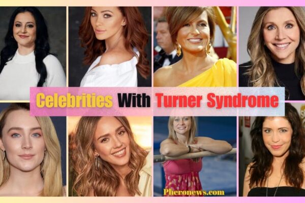Celebrities with turner syndrome