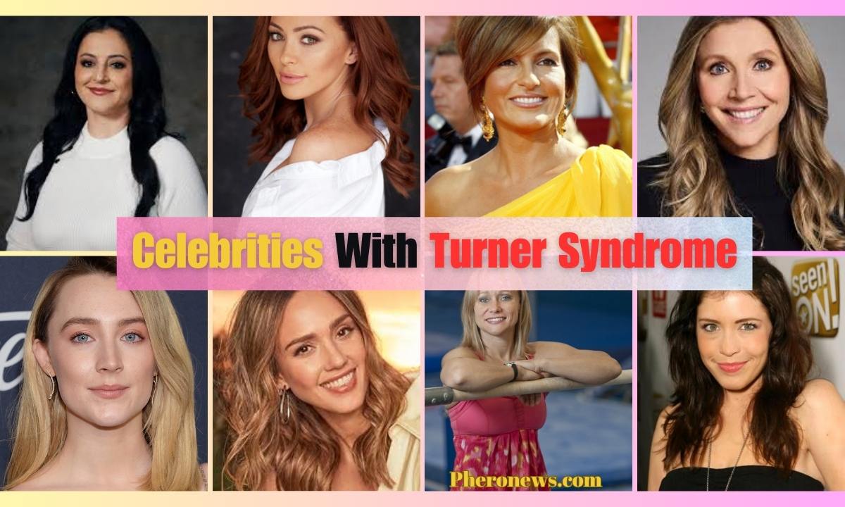 Celebrities with turner syndrome